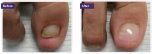 damage_nails_2